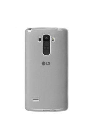 LG G4 Stylus Kılıf Soft Silikon Şeffaf-Siyah Arka Kapak…