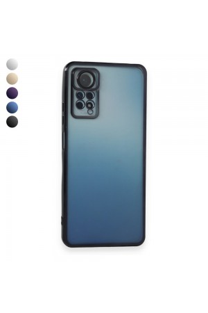 Xiaomi Redmi Note 11 / 11s Kılıf Razer Lens Çerçeveli Silikon Kapa…