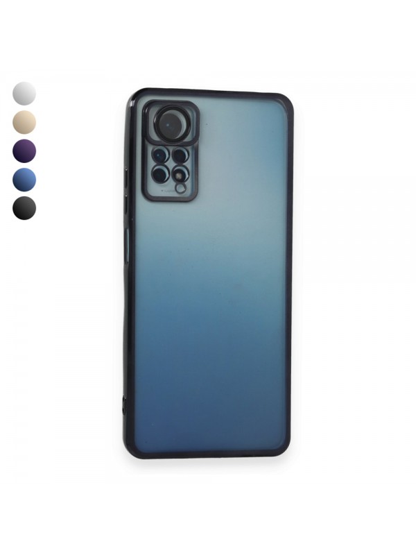 Xiaomi Redmi Note 11 / 11s Kılıf Razer Lens Çerçeveli Silikon Kapak…